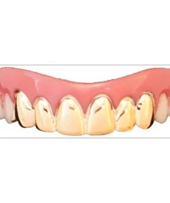 Swedia's Billy Bob Teeth - Gold Veneers